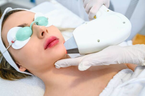 procedimento de rejuvenescimento da pele facial a laser